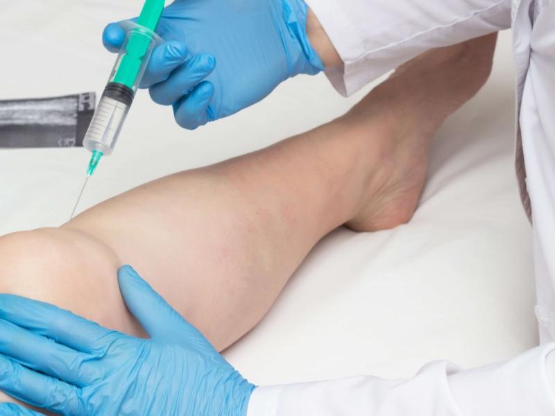 PRP injections and osteoarthritis: A promising option for cartilage regeneration