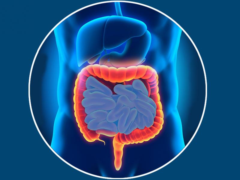 Chronic inflammatory bowel disease: what is it?