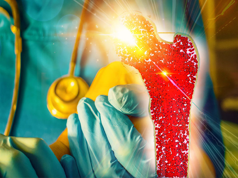 Síntomas del cáncer de médula ósea 2026