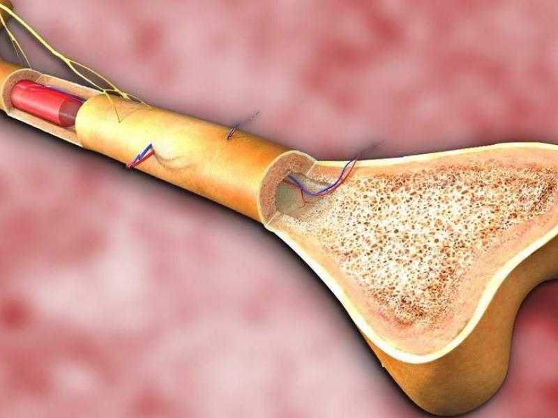 Principales tipos de cáncer de médula ósea 2026