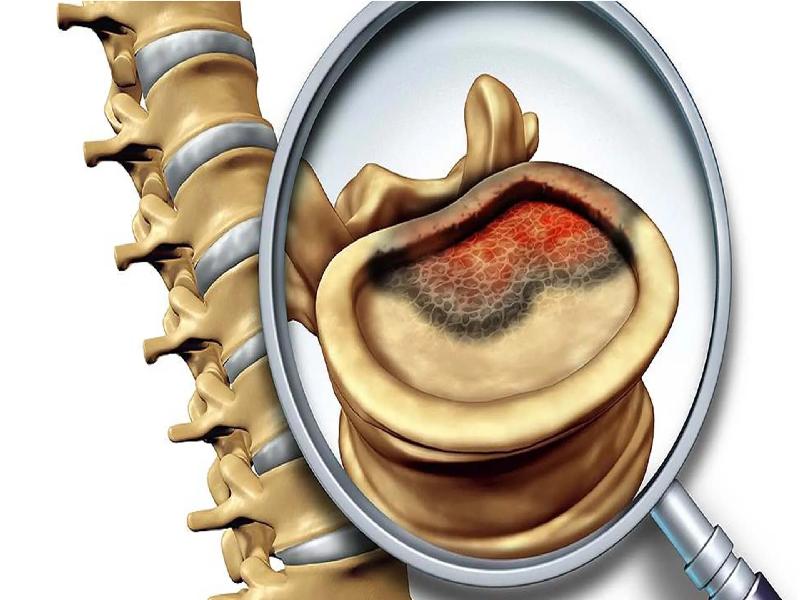 Ablation of a bone marrow tumor