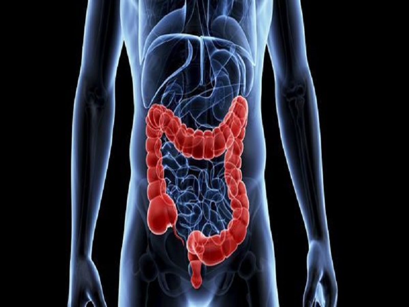 Síntomas del cáncer colorrectal 2026