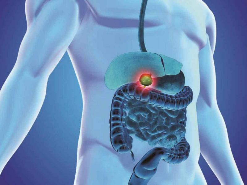 The cost of bile duct cancer treatment in Turkey 2026