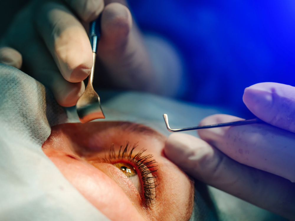 The refractive surgery process 2026