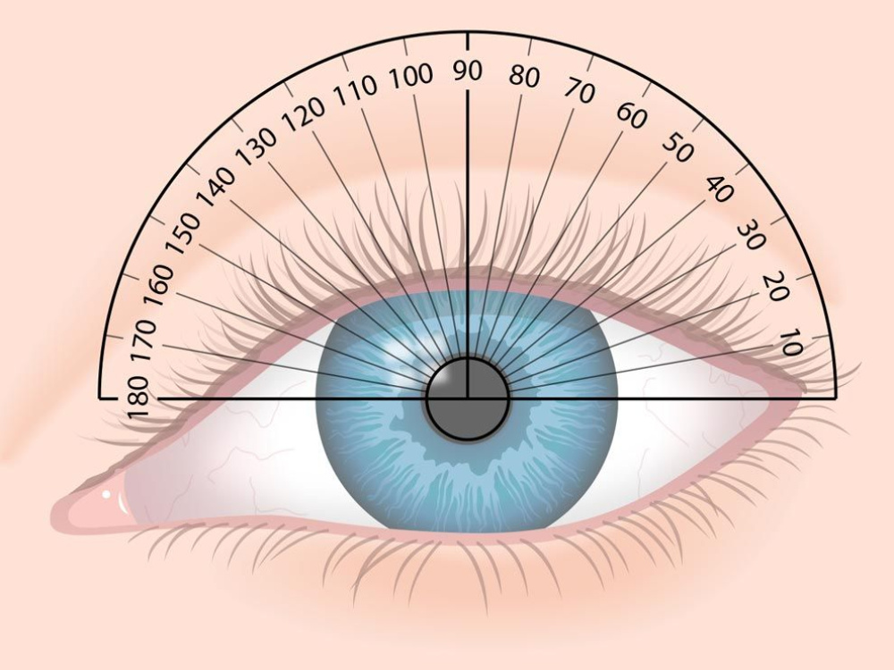 Corrección del astigmatismo en Turquía
