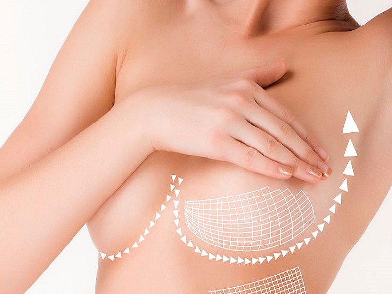 What is nipple cosmetic surgery in Turkey? 2026