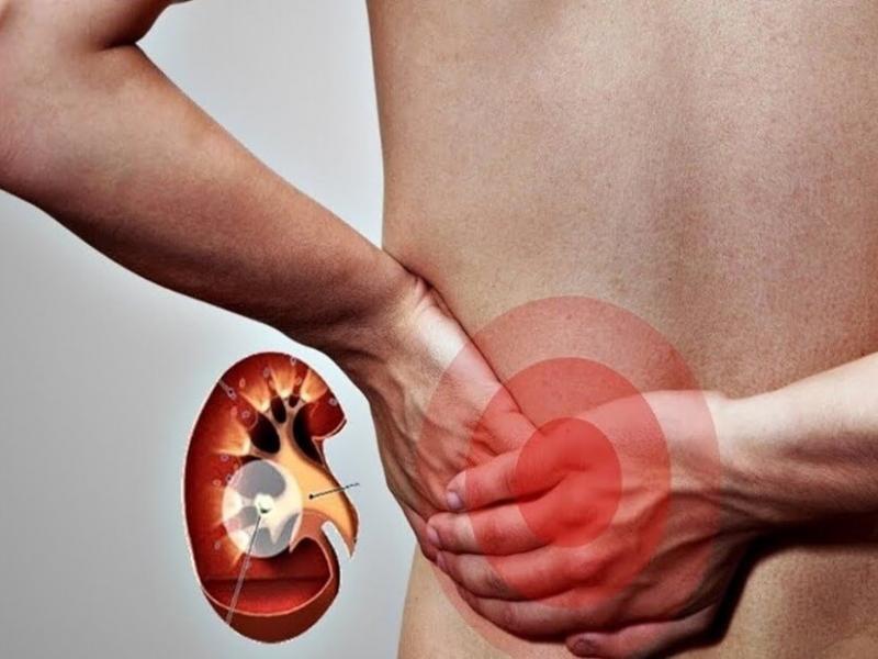 Indications for kidney transplant