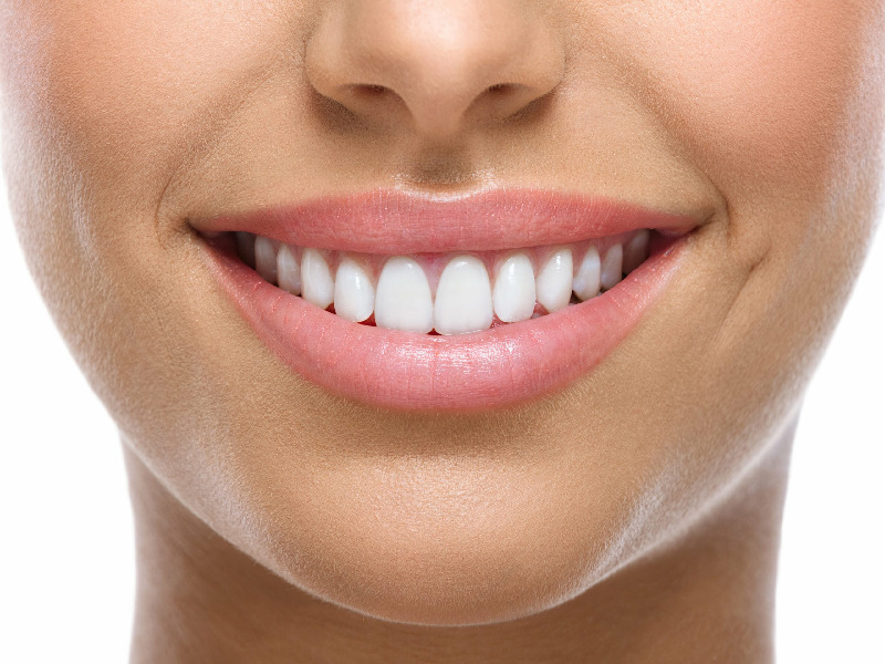 Hollywood smile treatment in Turkey Hollywood smile treatment in Turkey