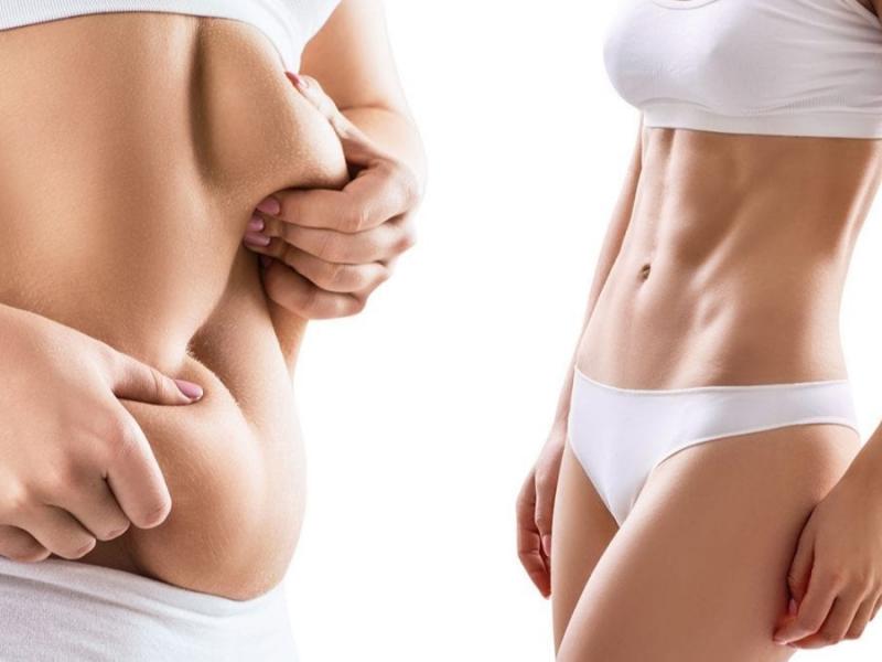 Full body lift surgery in Turkey