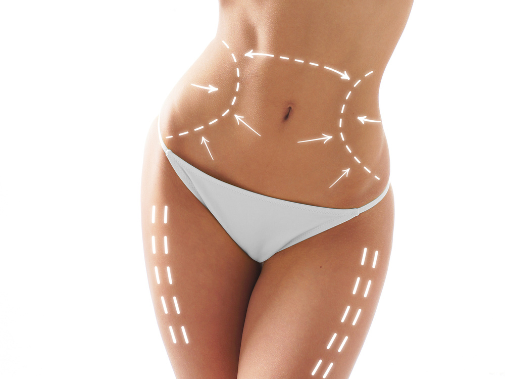 Body lift surgery in Turkey