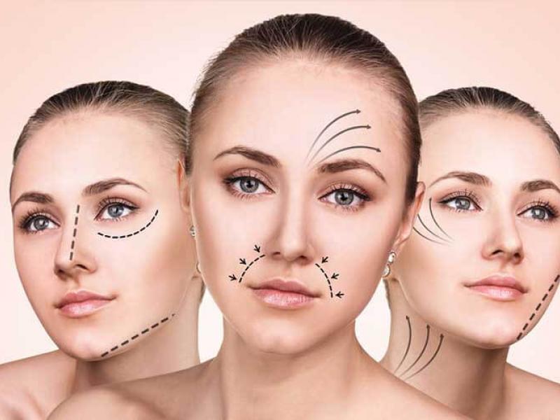 What exactly is a mini facelift? 2026