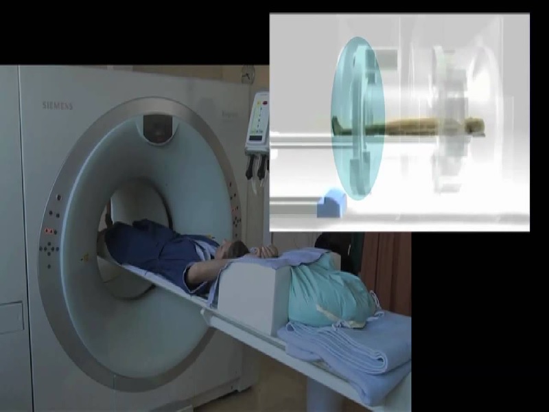 PetScan (PetCT) in Turkey Reviews, Price from 700