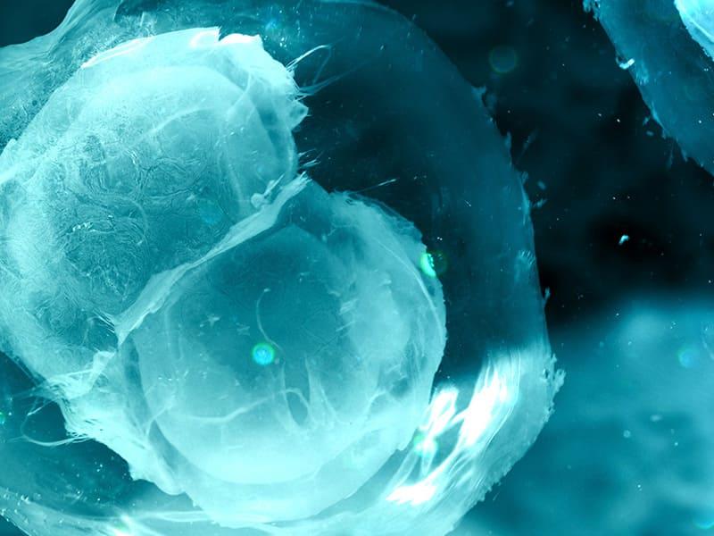 ovarian prp cost