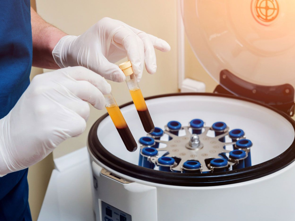ovarian rejuvenation cost
