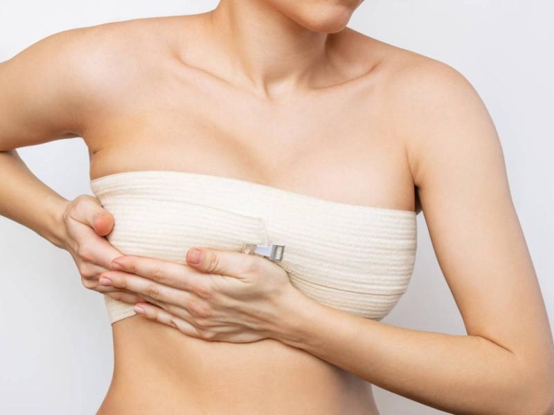 breast reconstruction surgery in turkey