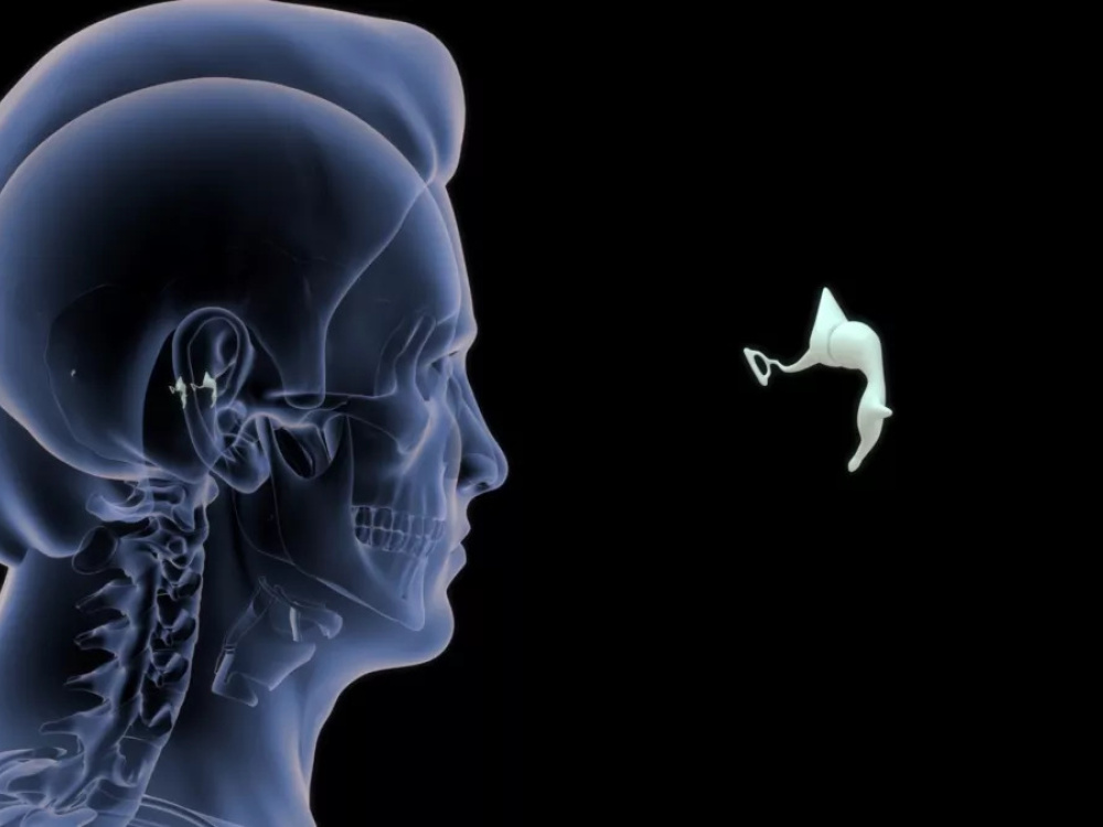 Diagnosis prior to stapedectomy 2026