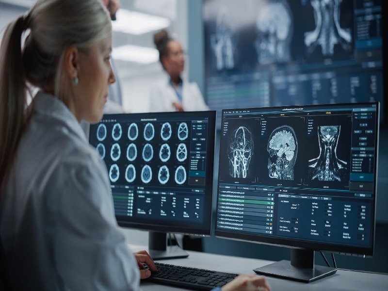 Tomodensitométrie CT-Scan Tomodensitométrie CT-Scan