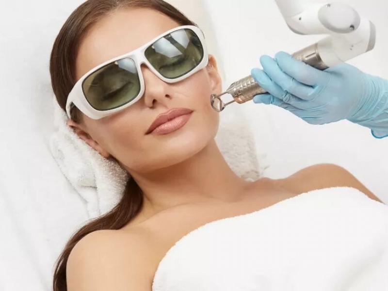 Why choose fractional CO2 laser treatment? 2026