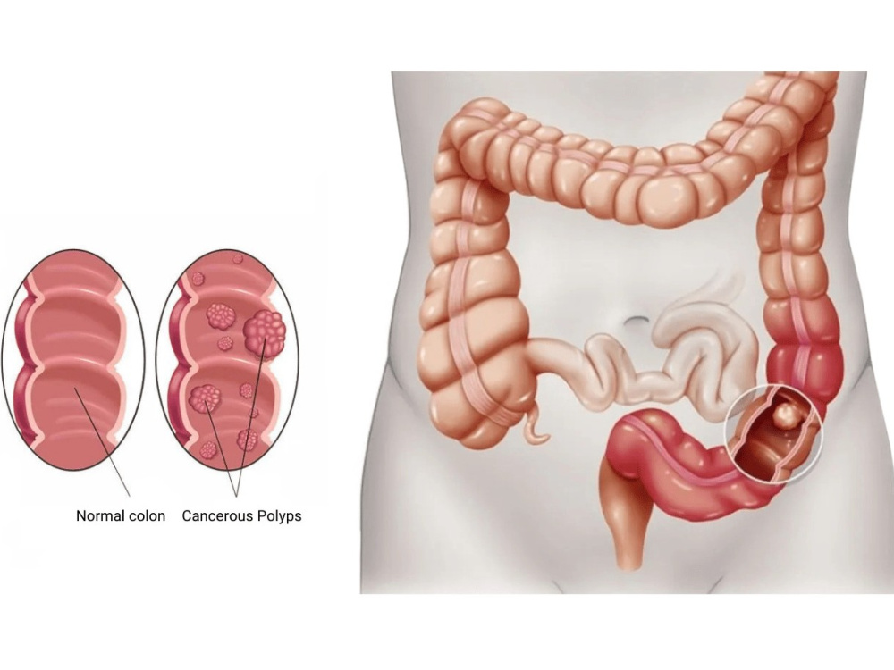 Screening and diagnosis 2026
