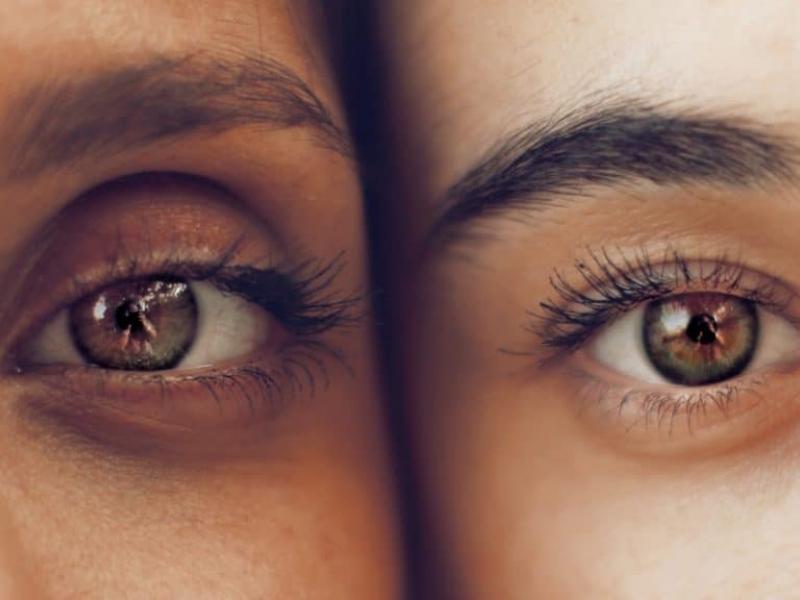 Understanding dark circles and their causes 2026 Understanding dark circles and their causes 2026