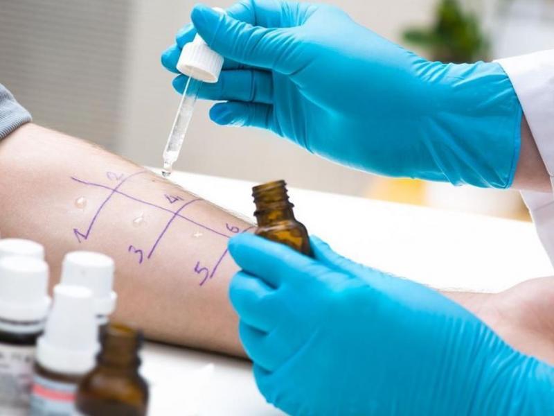 علاج الحساسية تركيا علاج الحساسية تركيا
