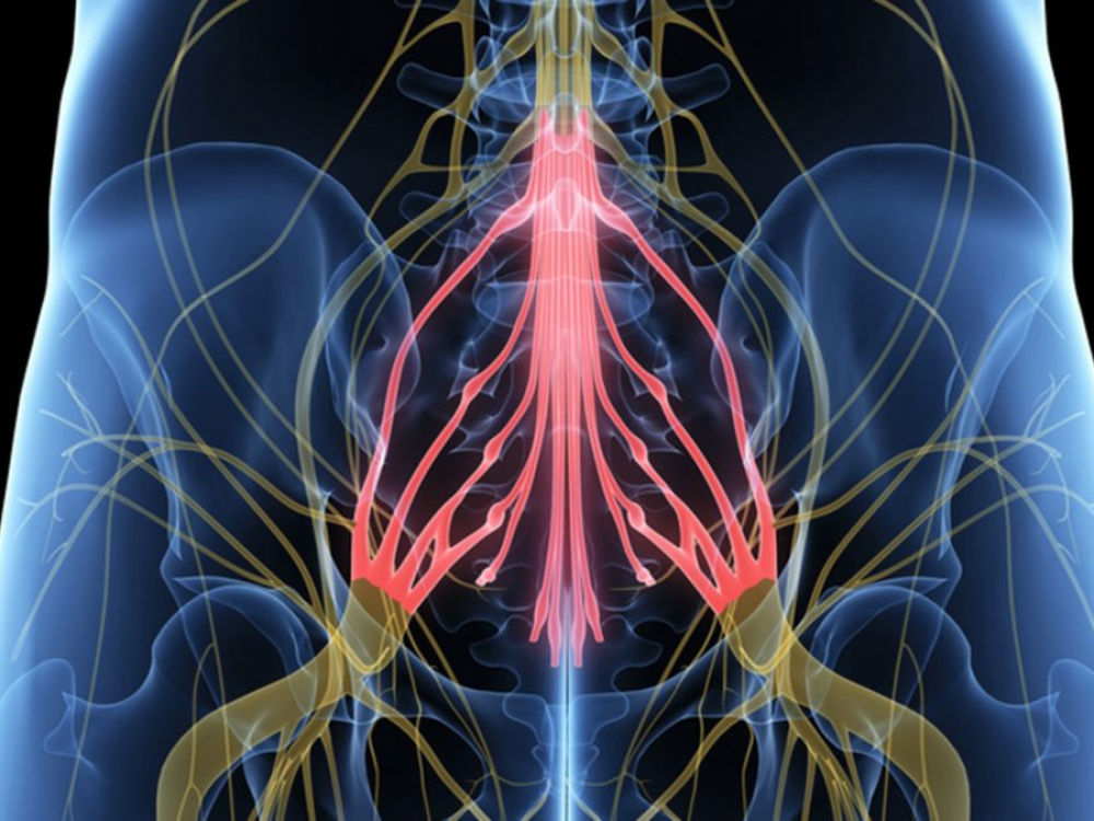 Causes of Cauda Equina Syndrome 2026